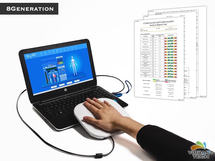 where to buy Quantum Resonance Analyzer Machine